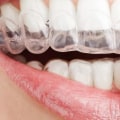 Are Invisalign Treatments Safe for Children's Teeth Alignment Needs?