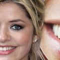A Beautiful Smile with Straight Teeth: Does it Make You More Attractive?