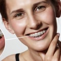 Straightening Teeth: What Gives the Best Results?