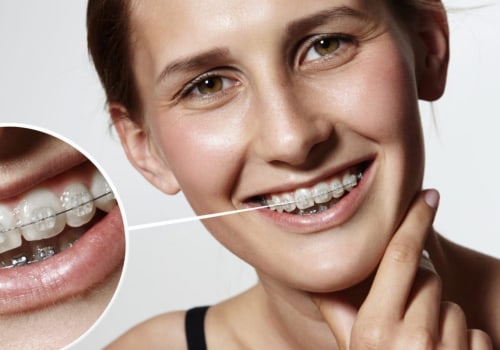 The Benefits of Straight Teeth: A Guide to Oral Health and Well-Being