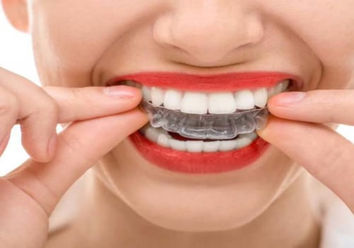 When is the Best Time to Get Teeth Straightening?
