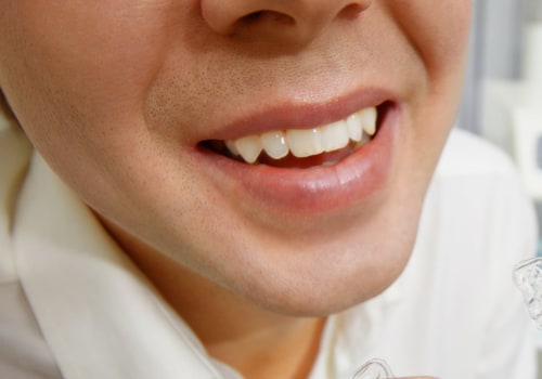 Is Teeth Straightening Painful? Expert Advice on Orthodontic Treatment