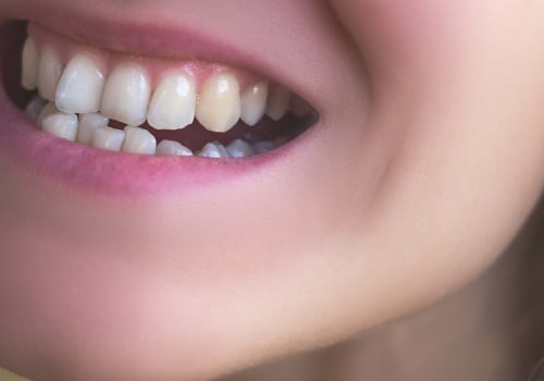 What are the Side Effects of Teeth Straightening?