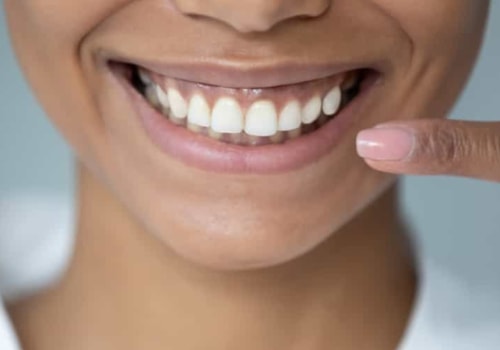 The Benefits of Straight Teeth: A Comprehensive Guide